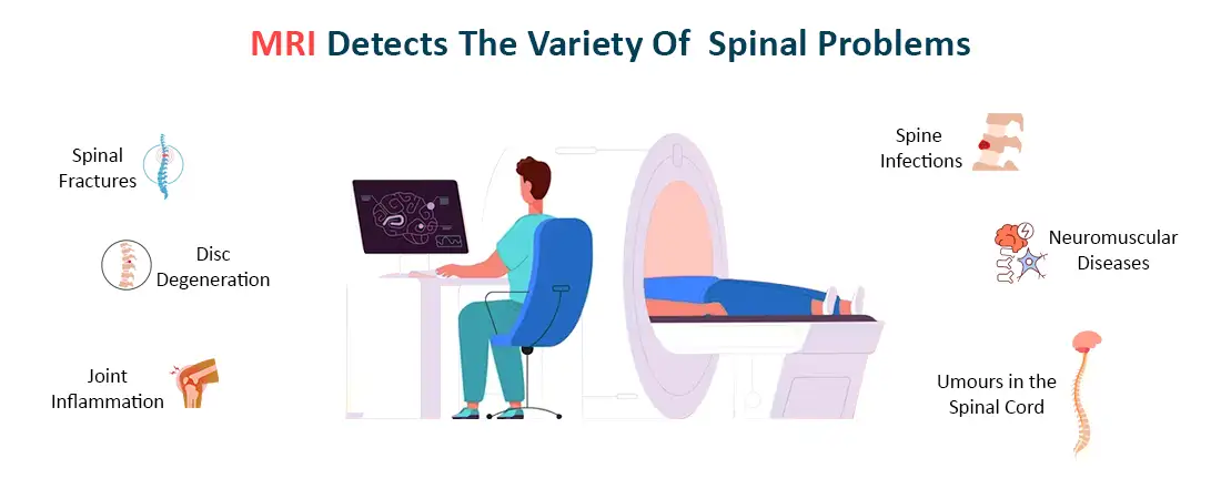 MRI Detects the Variety of Spinal Problems